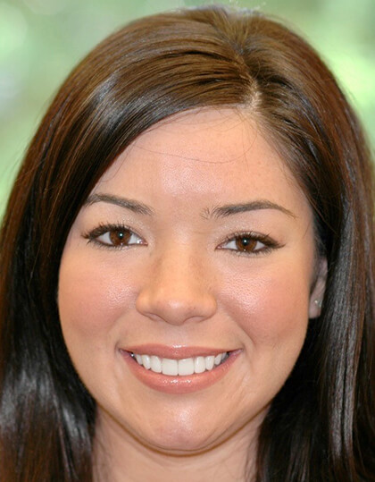 Closeup of Bronwen's smile before smile makeover