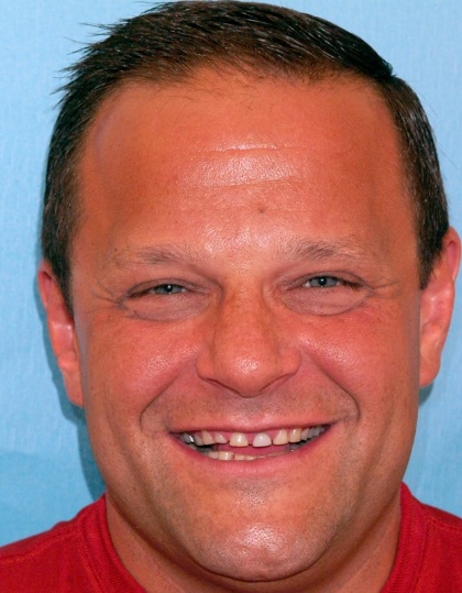 Steve smiling before smile makeover