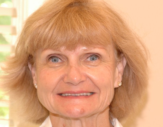 Joanne smiling before smile makeover